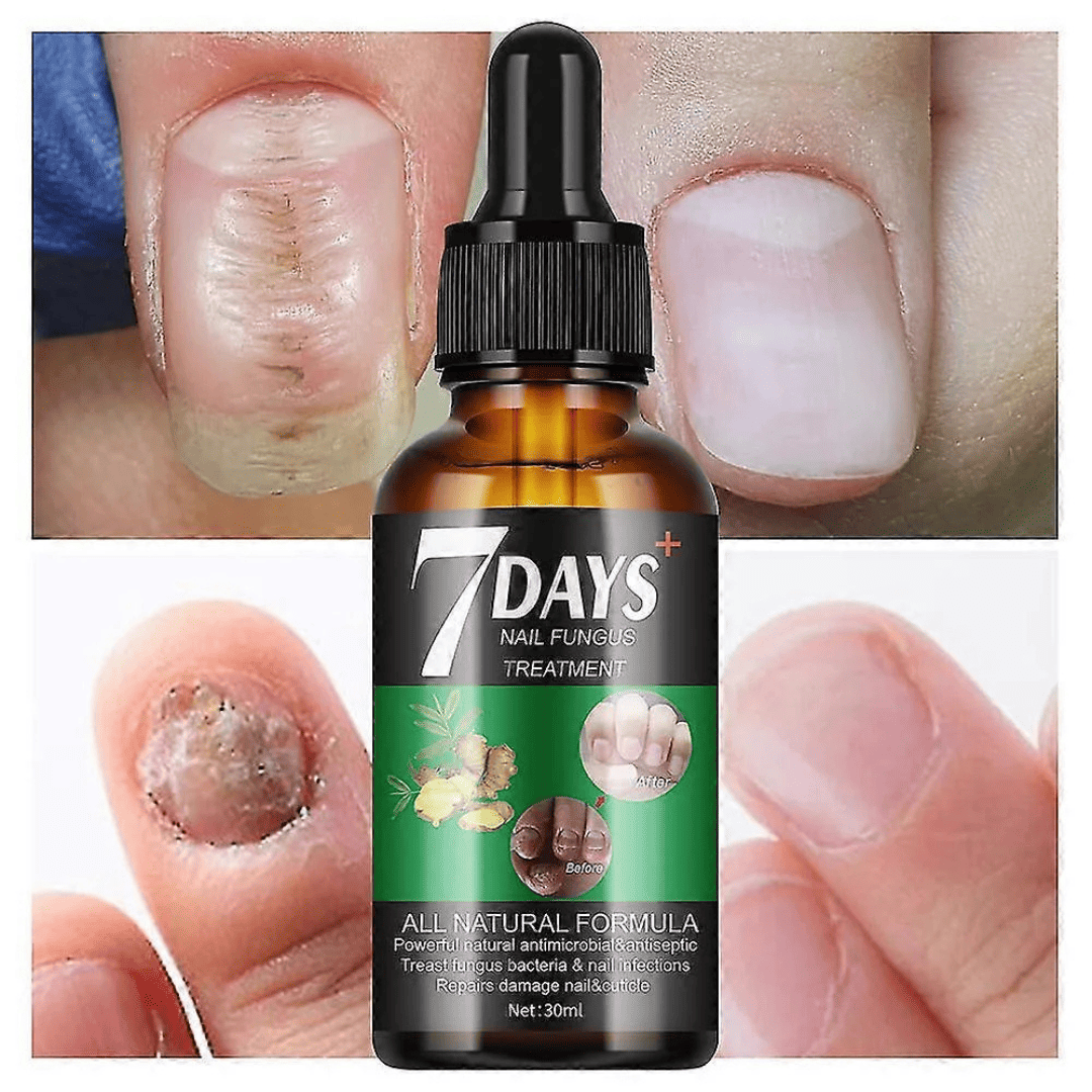 NailCare – Sérum Réparateur d’Ongles