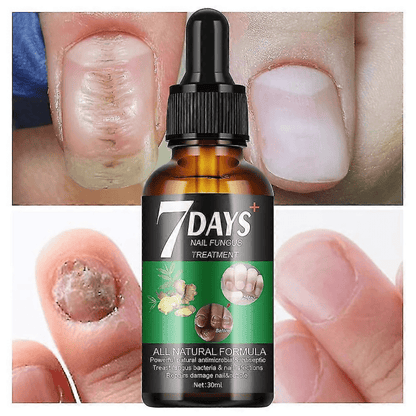 NailCare – Sérum Réparateur d’Ongles