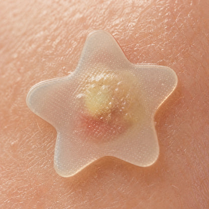 Patchs Étoiles Anti-Acné